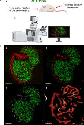 In Vivo and In Situ Approach to Study Islet Microcirculation: A Mini-Review